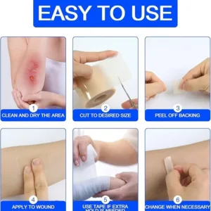 Hydrocolloid Bandages Roll 2" × 19.7' – Hydrocolloid Roll for Wound Care, Hydrocolloid Patch Large, Hydrocolloid Gel Bandages Hydrocolloid Dressing with Self-Adhesive, DIY Size Shape First Aid Kit
