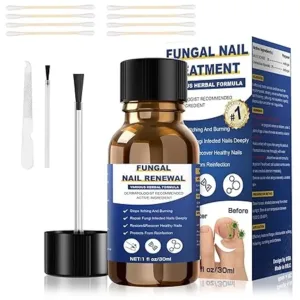 Toenail Fungus Treatment,Foot Fungus Treatment Extra Strength,Fungus Nail Treatment,Nail Fungus Treatment For Toenail, Toe Nail Fungus Treatments For Fungi Nail yellow toenail treatment(1fl oz/30ml)