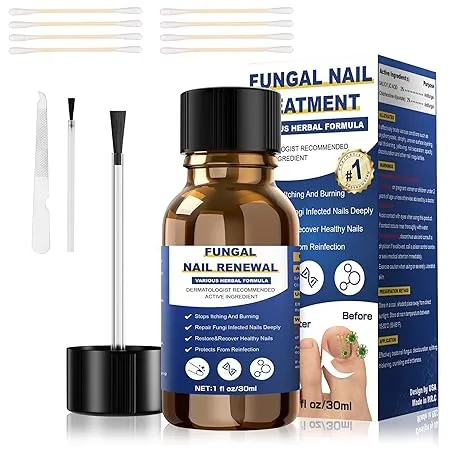 Toenail Fungus Treatment,Foot Fungus Treatment Extra Strength,Fungus Nail Treatment,Nail Fungus Treatment For Toenail, Toe Nail Fungus Treatments For Fungi Nail yellow toenail treatment(1fl oz/30ml)