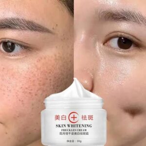Age spot
