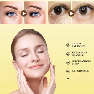 Milai remover